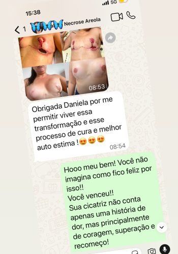 Camuflagem de Cicatrizes